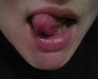 Gargona
